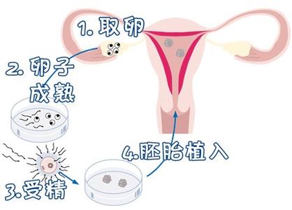 孕妈供卵代怀助孕咨询微信群试管婴儿中心
